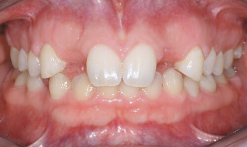 Pre-treatment dental images for patient evaluation