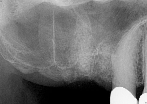 Detailed view of oral anatomy captured via advanced imaging