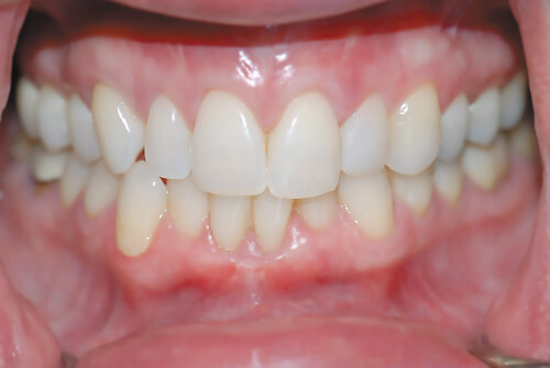 Dental assistant setting up treatment station