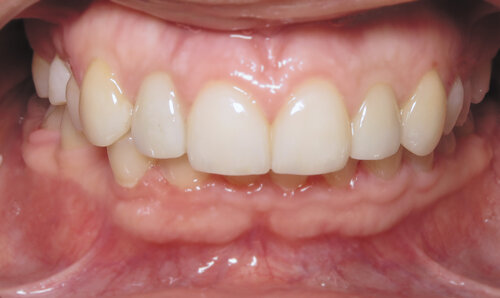 Intraoral imaging system at Beaverton Periodontics