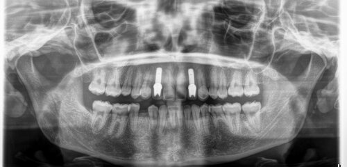 Panoramic dental imaging equipment in action