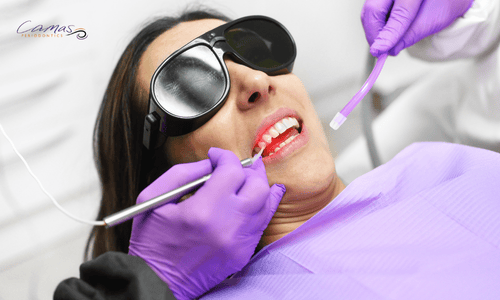 LASER FRENECTOMY PROCEDURE